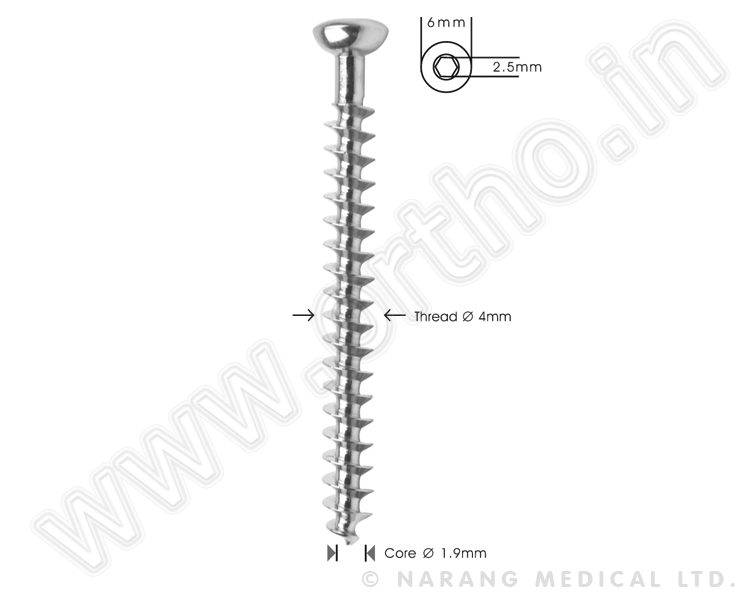 Vet Cancellous Bone Screw  Ø  4.0mm, Full-thread