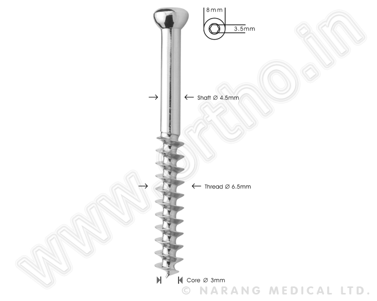 Vet Cancellous Bone Screw  Ø  6.5mm, 32mm Thread